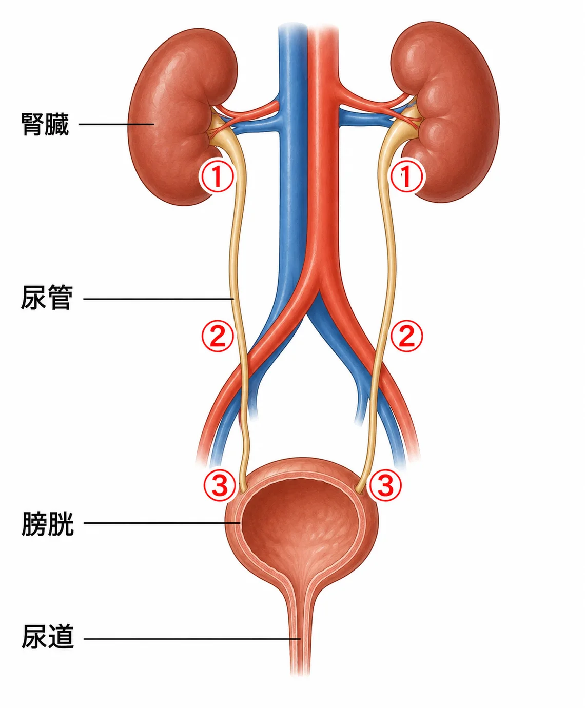 【体験記・続報】さて尿路結石がどうなったか、3回目の報告です。